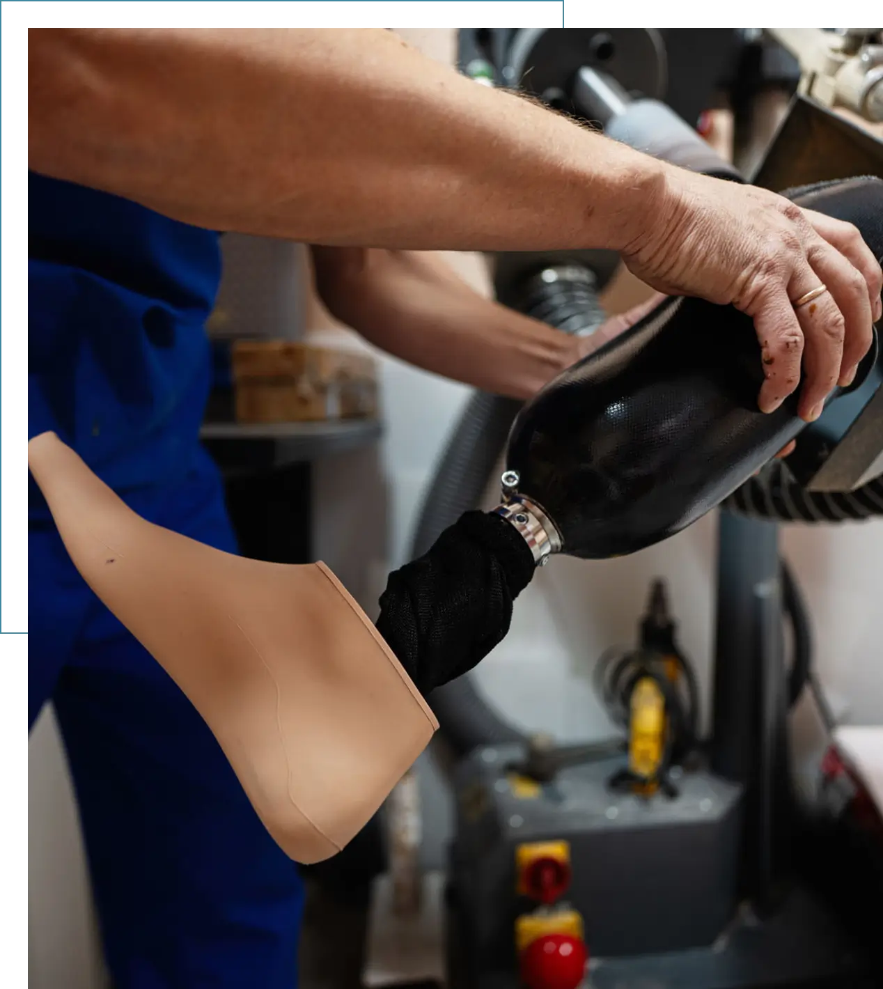 Prosthetic leg being adjusted by technician.