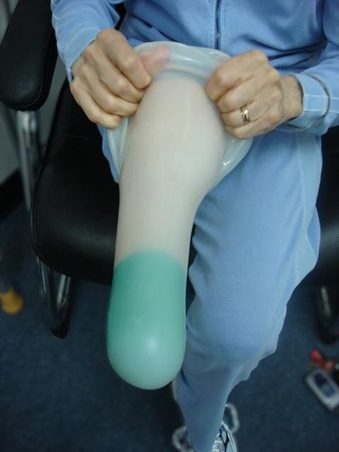 Person wearing a blue sock on a prosthetic leg.